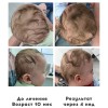 позиционная деформация черепа как исправить. Смотреть фото позиционная деформация черепа как исправить. Смотреть картинку позиционная деформация черепа как исправить. Картинка про позиционная деформация черепа как исправить. Фото позиционная деформация черепа как исправить