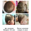 позиционная деформация черепа как исправить. Смотреть фото позиционная деформация черепа как исправить. Смотреть картинку позиционная деформация черепа как исправить. Картинка про позиционная деформация черепа как исправить. Фото позиционная деформация черепа как исправить