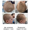 позиционная деформация черепа как исправить. Смотреть фото позиционная деформация черепа как исправить. Смотреть картинку позиционная деформация черепа как исправить. Картинка про позиционная деформация черепа как исправить. Фото позиционная деформация черепа как исправить