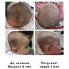 позиционная деформация черепа как исправить. Смотреть фото позиционная деформация черепа как исправить. Смотреть картинку позиционная деформация черепа как исправить. Картинка про позиционная деформация черепа как исправить. Фото позиционная деформация черепа как исправить