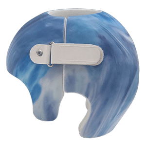 Ортопедический шлем. Требования к 3D сканеру - Ортотис Премиум