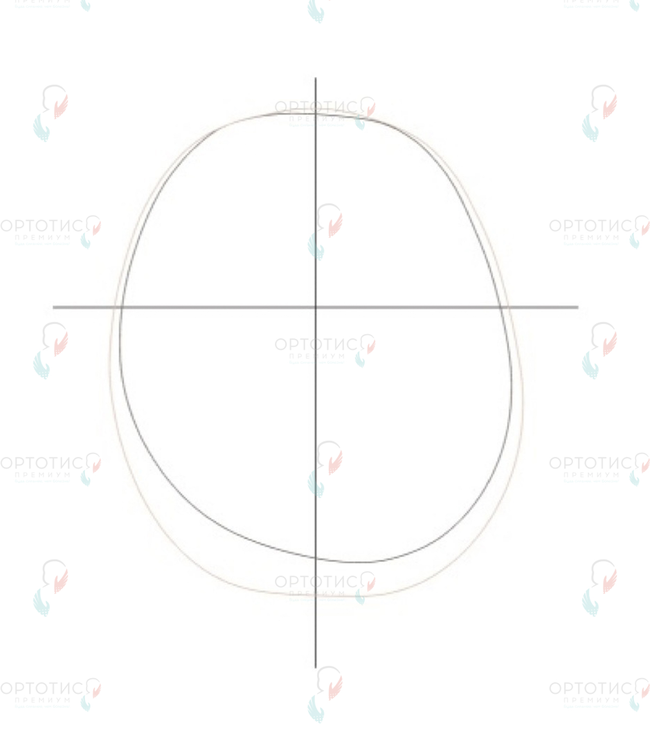 Позиционная асимметричная брахицефалия, 3,5 месяца - Ортотис Премиум